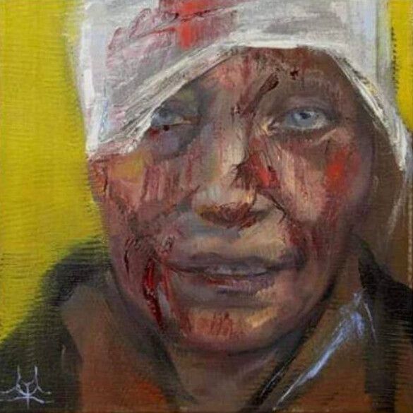 Портрет тяжело раненной в российской бомбардировке учительницы был продан на аукционе за 100,000.00$